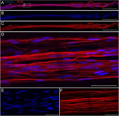 A three-dimensional tissue-engineered rostral migratory stream as an in vitro platform for subventricular zone-derived cell migration